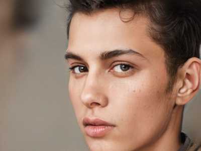 青少年发际线后移改善：纹发际线手术的风险与选择