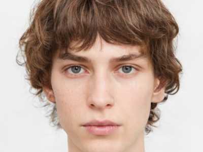 丽江韩式三点割双眼皮术后保养工作怎么做