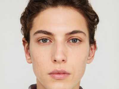 北京蜜邦医疗美容医院整形价位表超新新鲜大揭秘-热玛吉提升案例